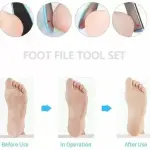 8 in 1 Pedicure Tool Kit for Feet Foot Scrubber for Dead Skin, Callus Remover(Set of 1).