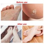 Stainless Steel, Foot Filer & Pedicure, Heel Scrubber Foot Scrubber for Dead Skin -Black