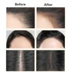 Conceals Hair Loss  Hair Powder Root Cover Up Black 1 Pcs