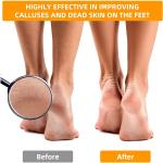Stainless Steel, Foot Filer & Pedicure, Heel Scrubber Foot Scrubber for Dead Skin -Black