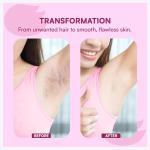 Women's Disposable Plastic Hair Razor & Bikini Shaving Razor For Women- Pack Of 1 (6 Pcs).