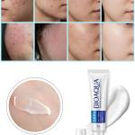 Whitening Moisturizing Skin Care Pimple Removal Cream (Pack of 1)