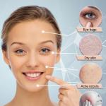 Ice Roller For Face Eyes and Neck To Brighten Skin & Enhance Your Natural Glow (Pack of 1)