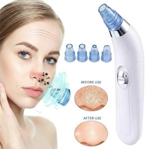 4-in-1 Blackhead Remover Tool Electric Device Facial Cleanser Vacuum System