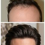 Vitamin-E Hair Capsule For Anti Hair Fall & Damage Repair for men and women  1 Pcs