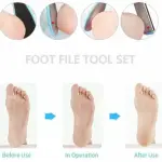 8 in 1 Pedicure Kit Foot Scrubber for Dead Skin  (70 g, Set of 8)