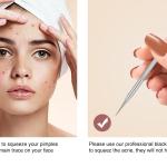 4pcs Dark Spot And Pimple Removing
