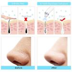 4-in-1 Blackhead Remover Tool Electric Device  1 Pcs