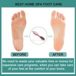 Foot File Callus Remover - 4 in 1 Feet Pedicure Tools(Pack of 1).Multicolor.