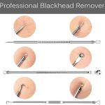 4 Pcs Blackhead Remover Cleaner Set Kit Stainless Steel