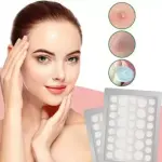 36 Patch Face Acne Pimple Patch - Pack of 1