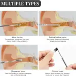 Ear Wax Removal Kit,6 Pcs Ear Pick Earwax Remover Tool Professional 1 Pcs