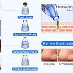 (1 piece)  Multi-Function Blackhead Whitehead Extractor Remover Sunction Device For Men and Women.