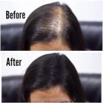Hair Building And Thickening Fibers for Natural Looking Hairs, Hair Loss Concealing Fillers for Instant Thickening of Thinning, Balding Hair.