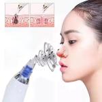 (1 piece)  Multi-Function Blackhead Whitehead Extractor Remover Sunction Device For Men and Women.