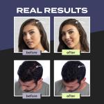 Hair Building Fibers For Thinning Hair Dark Brown For Both Men And Women (pack of 1).