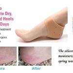 Silicone Half Heel Protector Socks Moisturizing Socks For Foot-Care, Heel.( 1 Pair).