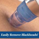 Multi-function Whitehead & Blackhead Remover Tool | Electric Device Machine |(Pack of 1).