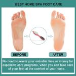 Foot File Callus Remover - 4 in 1 Feet Pedicure Tools(Pack of 1).Multicolor.