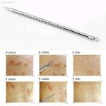 6 Pcs Stainless Steel Blackhead Whitehead  Pimple Remover