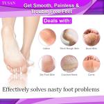 Soft Care Pedicure brush for foot (Pack Of 1)
