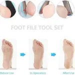 Pedicure Tools for Feet - 8 in 1 Pedicure Kit | Foot Scrubber for Dead Skin, Callus Remover, Foot Scraper, Foot File