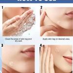 36 Patch Face Acne Pimple Patch - Pack of 1